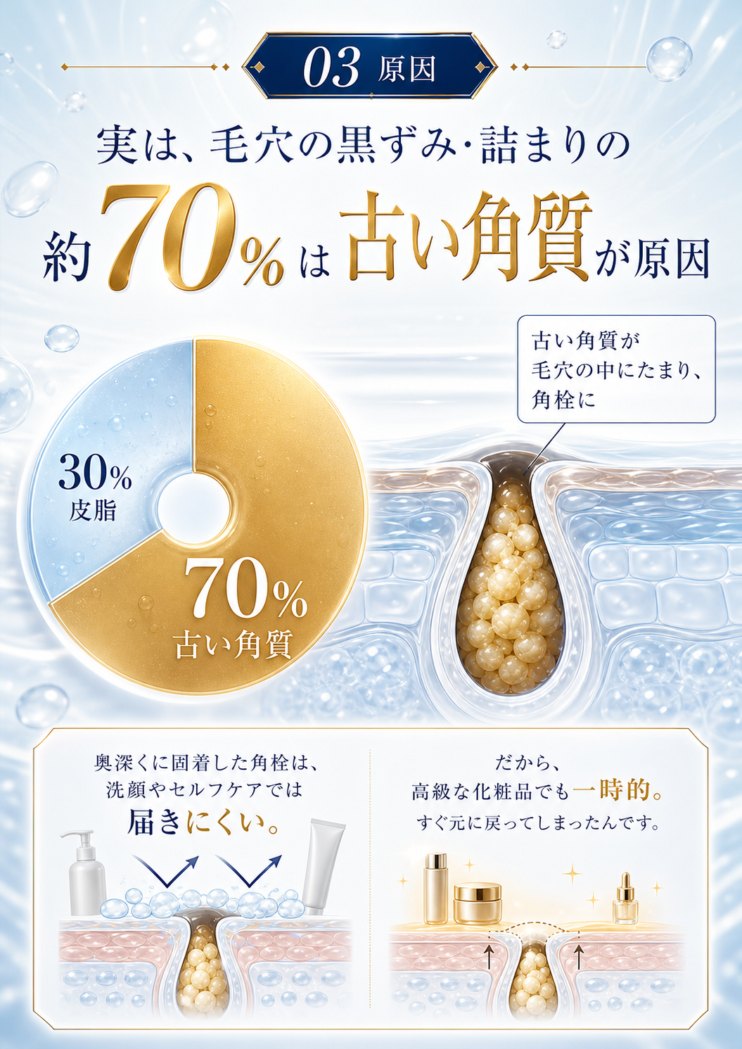 03 原因 — 実は、毛穴の黒ずみ・詰まりの約70%は古い角質が原因。古い角質が毛穴の中にたまり、角栓に。奥深くに固着した角栓は、洗顔やセルフケアでは届きにくい。だから、高級な化粧品でも一時的ですぐ元に戻ってしまったんです。