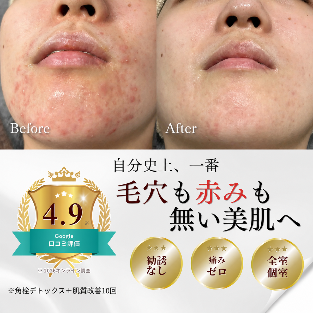 自分史上、一番 毛穴も赤みも無い美肌へ — 4.9 Google 口コミ評価 / 勧誘なし / 痛みゼロ / 全室個室