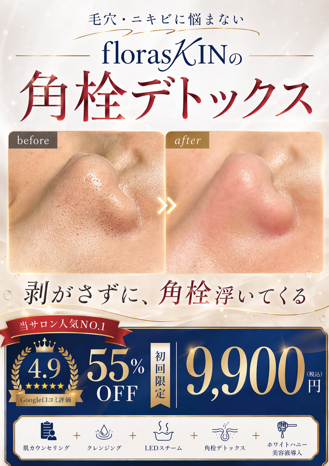 毛穴・ニキビに悩まない florasKINの角栓デトックス ｜ 剥がさずに、角栓浮いてくる 初回限定9,900円(税込) 55%OFF